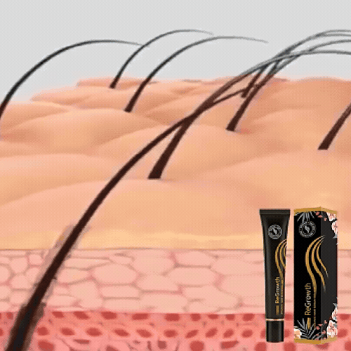 Root Force